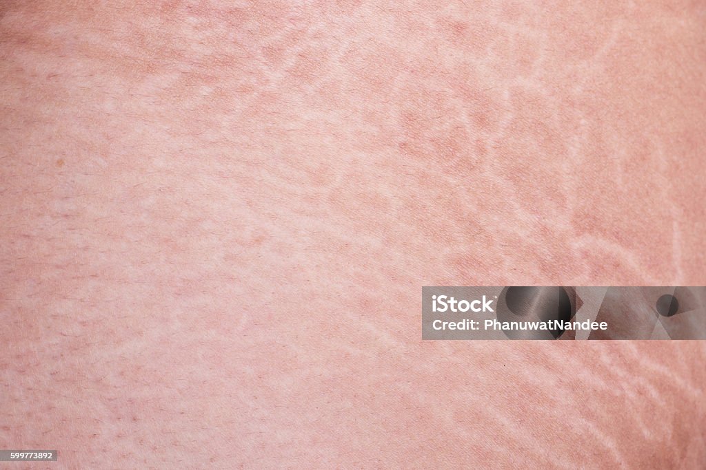 istock by PhanuwatNandee